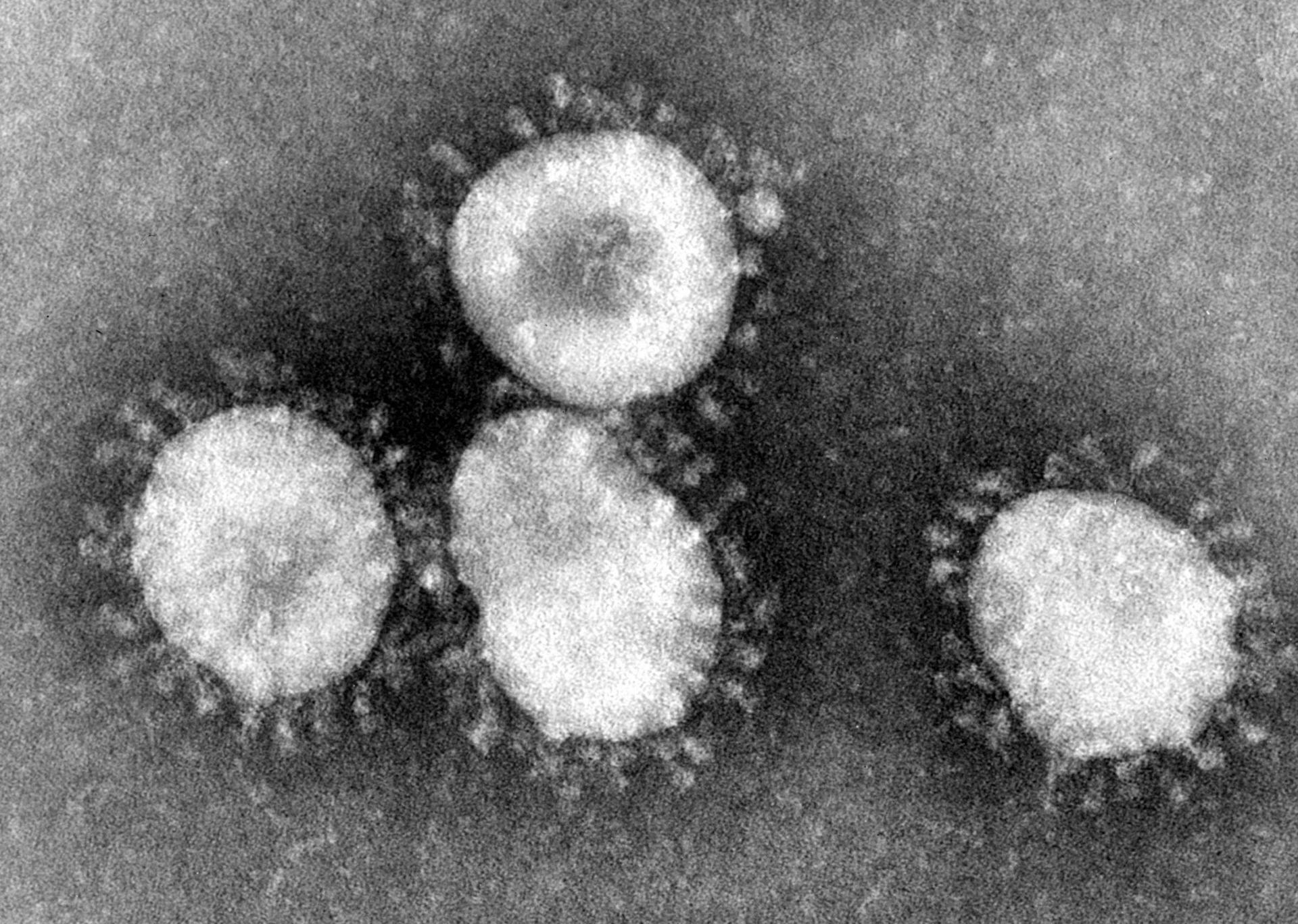 Il Coronavirus ucciderà la nostra economia? L’allarme di Federculture
