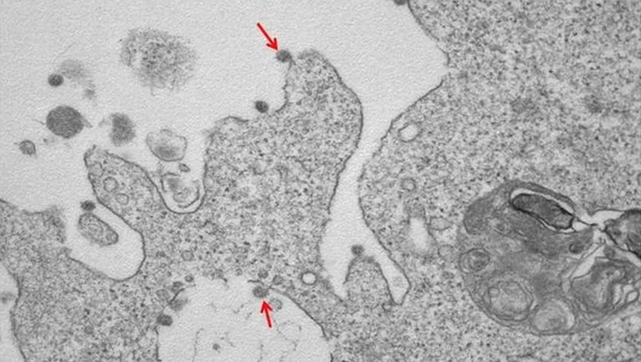 Ecco com’è fatto il Coronavirus. Prime foto realizzate all’ospedale Sacco di Milano